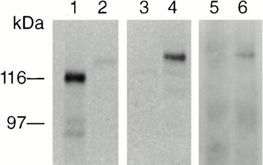 Fig. 5. In vitro translation and detection of Jak2. Approximately 1 μg Jak3 and Jak2 cDNAs were translated in a combined transcription and translation reticulocyte lysate system (Invitrogen) including (35S) methionine. Aliquots of each product were resolved on SDS-PAGE gel, followed by transfer to nitrocellulose and visualization by autoradiography. The reactions yielded proteins of 120 and 130 kD, corresponding to Jak3 and Jak2, respectively (lanes 1 and 2). The remaining lysate of each reaction was precleared with Protein A–Sepharose CL-4B and subsequently immunoprecipitated with anti-human Jak2 antibody, resolved by SDS-PAGE gel, electrotransferred to nitrocellulose membrane, and visualized by autoradiography. Only Jak2 was immunoprecipitated by the anti-human Jak2 antibody with no cross-reactivity to Jak3 (lanes 3 and 4). Only the immunoprecipitated Jak2 in lane 4 was detected by ECL (lane 6) after the same membrane was probed with an anti-mouse Jak2 antibody (PharMingen).