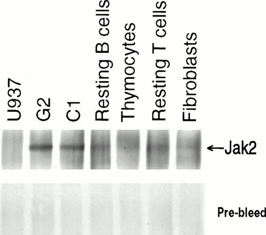 Fig. 6. Expression of human Jak2 protein. Immunoprecipitates were prepared from lysates containing 750 μg protein from each type of cell with antisera to human Jak2 and subjected to 6% SDS-PAGE. After transfer to nitrocellulose membrane, immunoblotting was performed with anti-Jak2 antibody (PharMingen) and detection was made by ECL.