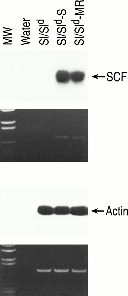 Fig. 2. Analysis of transgene expression in bone marrow–derived stromal cells from Sl/Sld,Sl/Sld-S, andSl/Sld-MR mice. Total cellular RNA was extracted as described in Materials and Methods. SCF-specific primers (upper panel) were used that recognize only the full-length transcript of SCF. As a loading control actin specific primers (lower panel) were used on the same RNA sample as described in Materials and Methods. RT-PCR products were examined on 1% ethidium bromide containing agarose gel and subsequently probed with SCF and actin specific probes. Upper arrow, SCF-specific primers (733 bp); lower panel, actin-specific primers (732 bp). Molecular weight (MW) marker is shown on the left.