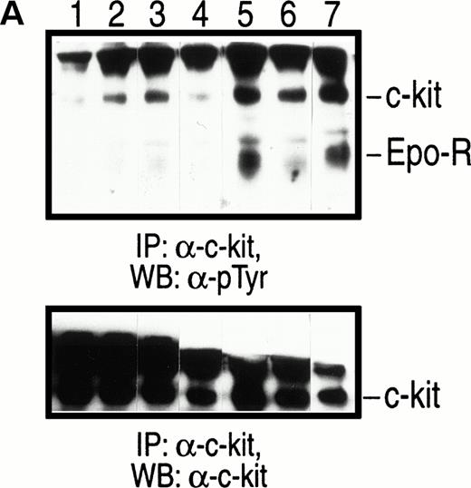 Fig. 5. Coimmunoprecipitation and phosphorylation of c-kit and EPO-R in HCD57 cells. (A) Stimulation with MR and soluble SCF. Factor-starved HCD57 cells were cocultured with mitomycin C–treated stromal cells expressing either the soluble (Sl/Sl4-S) or the MR (Sl/Sl4-MR) form of SCF for various periods of time at 37°C as described in Materials and Methods. Subsequently at various times, cell lysates were collected and subjected to IP with an anti–c-kit antibody and WB analysis with an anti-phosphotyrosine antibody and the enhanced chemiluminescence detection system. Coimmunoprecipitated and tyrosine-phosphorylated Golgi-processed c-kit (slow migrating)27 and EPO-R are indicated. Lane 1 corresponds to parental Sl/Sl4 cells cocultured for 10 minutes; lanes 2, 4, and 6 correspond to Sl/Sl4-S cells cocultured for 10, 60, and 120 minutes, respectively; lanes 3, 5, and 7 correspond to Sl/Sl4-MR cells cocultured for 10, 60, and 120 minutes, respectively. (B) Stimulation with EPO. Factor-starved HCD57 cells were exposed to no growth factor (lane 1) or stimulated with 10 μ/mL rhEPO for 5 minutes (lane 2) and for 10 minutes (lane 3). Cell lysates were subjected to IP using an anti–EPO-R antibody and WB using an anti-phosphotyrosine antibody as described above. Tyrosine-phosphorylated EPO-R is indicated.