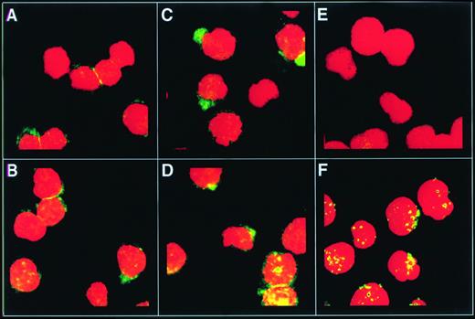 Fig. 5. The c-kit receptor clusters on the cell surface within 3 minutes of exposure to SCF. MO7e cells were exposed to SCF (200 ng/mL) for 0 minutes (A and B), 3 minutes (C and D), or 30 minutes (E and F) at 37°C. One portion of each aliquot of cells was stained with 104D2 followed by goat antimouse IgG-FITC to detect cell surfacec-kit receptor (A, C, and E). The other portion of each aliquot of cells was permeabilized with Triton X-100 to permit detection of intracellular c-kit receptor in addition to cell surfacec-kit receptor (B, D, and F), then stained as described above. The cells were analyzed by confocal microscopy.