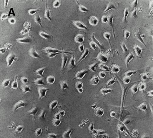 Fig. 1. Characterization of LEC-1 clones. (A) Phase contrast microscopy of attached LEC-1 (A12 clone) 2 days after culture in IMDM 20% FCS. Note the spindle like morphology of these endothelial cells (original magnification × 20). Fluorescence-activated cell sorting (FACS) analysis of LEC-1 showing the expression of CD34 (B), VCAM-1 (C), and ICAM-1 (D) (thin line). Negative controls were stained with the respective isotype (black profile). Similar results were obtained with the C7 clone.