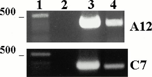 Fig. 4. c-mpl mRNA expression in murine LEC-1. RT-PCR was performed on 1 μg total RNA obtained from A12 and C7 LEC-1 clones. Reverse-transcription and amplification were performed as described in Materials and Methods with the primers specific for c-mpl. Constitutive expression for c-mpl was detected in both A12 and C7 LEC-1 clones. 1: Molecular markers; 2: negative control (PCR reaction without RNA template); 3: internal control, β-actin; 4: c-mpl.