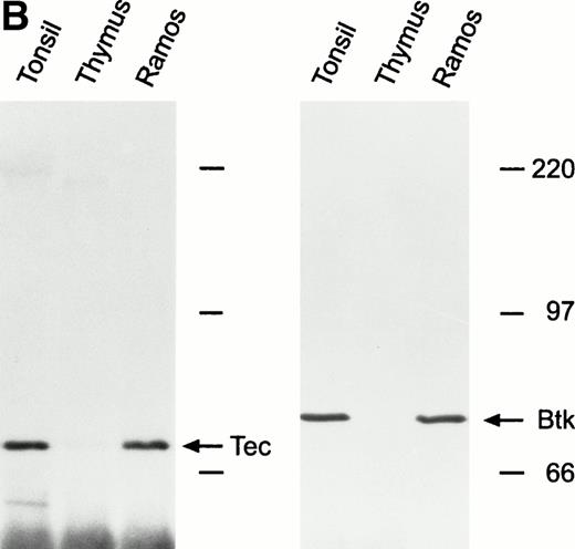 Fig. 1. Expression of Tec and Btk in human B cells. After immunoprecipitation with rabbit antisera to Tec or Btk, Western blots were probed with goat antisera against these proteins. (A) Tec was expressed in all B-cell lines studied representative of different stages of maturation, including two EBV-transformed lymphoblastoid cell lines derived from patients with XLA and lacking Btk expression. The myeloid cell line K562 and the T-lymphoid cell line Jurkat were used as a positive and negative control, respectively. (B) Tec and Btk were also expressed in tonsillar lymphoid cells, but not in thymocytes. Molecular mass markers (in kD) are indicated. The intense band of approximately 50 kD corresponds to the Ig heavy chain of the antibody used for immunoprecipitation.