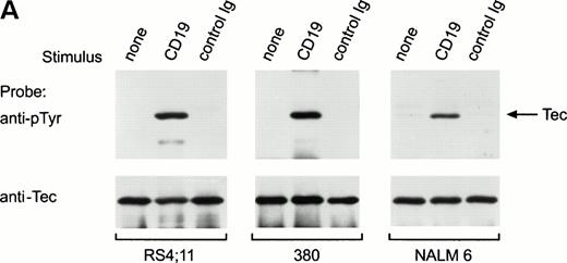 Fig. 3. Ligation of CD19 in immature B cells induces tyrosine phosphorylation and activation of Tec. (A) Immature B-cell lines, RS4;11, 380, and NALM6 were incubated with anti-CD19 monoclonal antibody or isotype-matched nonreactive Ig for 15 minutes at 4°C followed by goat antimouse Ig antiserum for 1 minute at 37°C. Proteins immunoprecipitated with anti-Tec rabbit antibody were separated by SDS-PAGE and transferred to a nitrocellulose membrane. The membrane was probed with antiphosphotyrosine antibody (pTyr; upper panel), then stripped and reprobed with anti-Tec rabbit antibody (lower panel). The position of Tec is indicated. (B) CD19 cross-linking in immature B cells increases Tec kinase activity. RS4;11 cells were stimulated as above and Tec kinase activity was assessed by in vitro kinase assay. Molecular mass markers (in kilodaltons) are indicated. The position of Tec is indicated by the arrow.