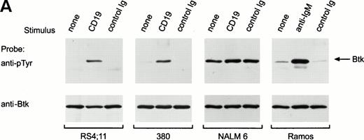 Fig. 4. Ligation of CD19 in immature B cells induces tyrosine phosphorylation and activation of Btk. (A) Immature B-cell lines, RS4;11, 380, and NALM6 were incubated with anti-CD19 monoclonal antibody or isotype-matched nonreactive Ig for 15 minutes at 4°C followed by goat antimouse Ig antiserum for 1 minute at 37°C. Proteins immunoprecipitated with anti-Btk rabbit antibody were separated by SDS-PAGE and transferred to a nitrocellulose membrane. The membrane was probed with antiphosphotyrosine antibody (pTyr; upper panel), then stripped and reprobed with anti-Btk goat antibody (lower panel). The position of Btk is indicated. In RS4;11 and 380 cells, cross-linking of CD19 induced tyrosine phosphorylation of Btk, as 5-minute exposure to anti-IgM antibody did in Ramos cells.33-35 In NALM6 cells, Btk appeared to be strongly tyrosine phosphorylated before CD19 ligation and no increase in phosphorylation was detected. (B) Kinetics of CD19-mediated tyrosine phosphorylation of Btk. CD19 was cross-linked on RS4;11 cells for the times indicated (minutes). Tyrosine phosphorylation of Btk was assessed as above. (C) CD19 ligation increases Btk kinase activity. The 380 cells were stimulated as above for 1 minute and Btk kinase activity was assessed by in vitro kinase assay. Molecular mass markers (in kilodaltons) are indicated. The position of Btk is indicated by the arrow.
