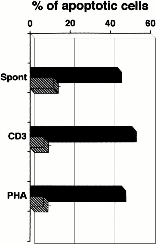 Fig. 4. Increased rates of apoptotic cells in unstimulated and stimulated cultures of PBMC of the patient (▪) compared with 10 age-matched healthy controls (▨). Data of healthy controls are expressed as mean ± 1 SD. All cultures were performed for 72 hours.