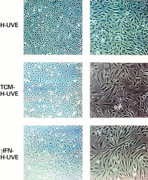 Fig. 3. γIFN and TCM induce HUVE cells to acquire a spindle morphology. Shown are HUVE cells (left panels, original magnification × 40; right panels, original magnification × 100) cultured under standard conditions (HUVE) or after 6 days of culture in the presence of TCM (TCM-HUVE) or 103 U/mL of γIFN (γIFN-HUVE).