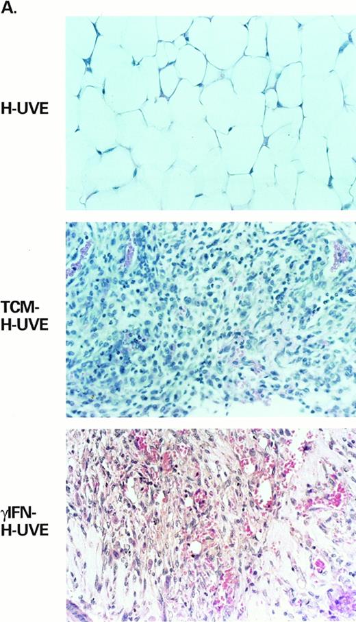 Fig. 4. γIFN-treated or TCM-treated HUVE cells induce KS-like lesions in nude mice. Lesion formation is associated with expression of bFGF. (A) Shows examples of the histopathology (H & E staining, original magnification × 400) and (B) shows bFGF expression by immunohistochemistry in the same tissues from mice inoculated with untreated HUVE cells (HUVE), TCM-treated HUVE cells (TCM-HUVE), or γIFN-treated HUVE cells (γIFN-HUVE), respectively.