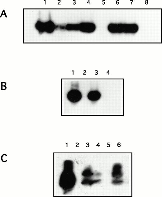 Fig. 4. Representative Southern Blot analysis of a nested PCR by using KS1 and KS2 primers to amplify HHV-8 DNA sequences. (A) Lane 1, positive control; lanes 2 to 4 and 6 to 7, lesional skin from C-KS and AIDS-KS patients, respectively; lane 5, uninvolved skin; lane 8, negative control. (B) Lesional skin cultures from C-KS patients: lane 1, positive control; lane 2, negative control; lanes 3 and 4, cultured skin from 2 C-KS patients. (C) PBMC: lane 1, positive control; lane 2, negative control; lanes 3 to 6, PBMC from four C-KS patients; lane 4, PBMC from an AIDS-KS patient.