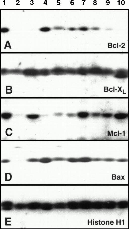 Fig. 2. Examination of relative Bcl-2, Mcl-1, Bcl-xL, and Bax polypeptide levels in human AML samples. Samples containing 3 × 105 HL-60 cells (lane 1) or 3 × 105marrow mononuclear cells from nine AML patients (lanes 2 through 10) were subjected to SDS-PAGE followed by Western blotting with the indicated antibody.