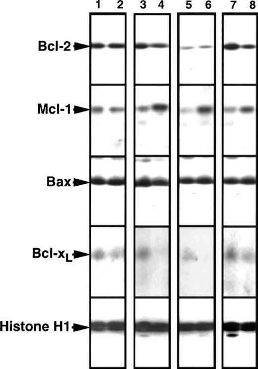 Fig. 5. Comparison of Bcl-2, Mcl-1, Bcl-xL, and Bax levels in paired leukemia specimens harvested before chemotherapy and at the time of leukemia recurrence. Odd numbers, pretreatment specimens. Even numbers, corresponding samples at recurrence. To permit quantitation, a serial dilution of HL-60 cells was run on each blot as depicted in Fig 1. Lanes 1 and 2 contain a pair displaying no twofold change in protein expression between diagnosis and relapse. Lanes 3-8 contain pairs displaying more than twofold increases in Mcl-1 expression at relapse. In two cases (lanes 3 through 6) there was no change in Bcl-2 expression; but in one case Bcl-2 expression decreased (lanes 7 and 8).