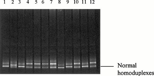 Fig. 1. DGGE of the amplified exon 10 of factor V gene. Lanes 1 and 3, contol with a homozygosity for G1691→A mutation. Lane 2, control with a heterozygosity for G1691→A mutation. Lane 8, normal control. Lanes 9 and 11, homozygous for G1628→A mutation. Lanes 4 through 7, 10, and 12, heterozygous for G1628→A mutation. (Upstream primer, GC40-TCAGG CAGGA ACAAC ACCAT; downstream primer, GGTTA CTTCA AGGAC AAAAT.).