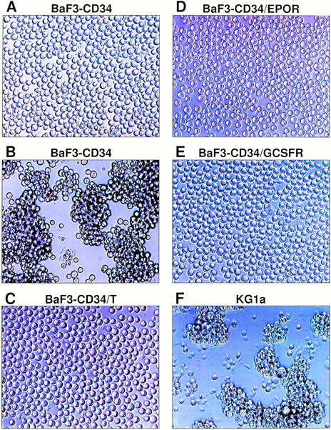 Fig. 3. Homotypic aggregation of the BaF3 cell transfectants upon addition of anti-CD34 MoAb QBEND 10. BaF3-CD34 cells were incubated with the negative control MoAb (A) or anti-CD34 MoAb QBEND 10 (B), which represents the typical morphology of homoaggregate formation of BaF3-CD34 cells (score, 3+). Similarly, BaF3-CD34/T cells (C), BaF3-CD34/EPOR cells (D), and BaF3-CD34/G-CSFR cells (E) were treated with MoAb QBEND 10. As a positive control, KG1a cells were also incubated with MoAb QBEND 10 (F). The final concentration of MoAb is 5 μg/mL. This experiment has been repeated five times with similar results.