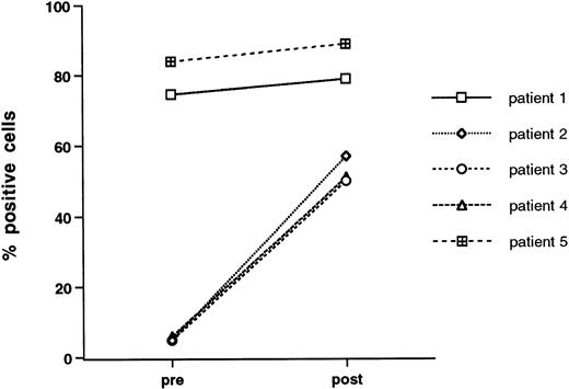 Fig. 5. Effect of growth factor stimulation on the expression of LFA-1 (CD11a) by CD34+ cells. Freshly isolated mobilized CD34+-selected PBPCs and cytokin-activated (IL-3, IL-6, and SCF for 3 days) mobilized CD34+ PBPCs were double stained for CD34 and LFA-1. Data are given for each of five patients studied and are the percentage of CD34+ cells that express LFA-1.