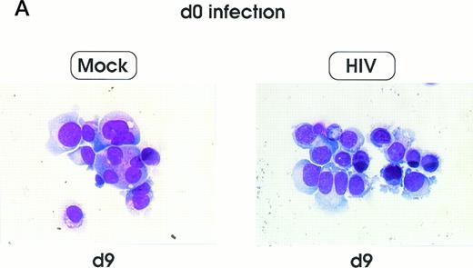 Fig. 5. Cell morphology of mock and HIV-infected MKs (representative results). Cells from day 0 infection harvested at day 9 (A) and at day 12 (B). MKs infected at day 5 and recovered at day 12 (C). May-Grünwald staining; original magnification × 400.