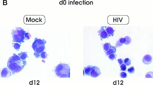 Fig. 5. Cell morphology of mock and HIV-infected MKs (representative results). Cells from day 0 infection harvested at day 9 (A) and at day 12 (B). MKs infected at day 5 and recovered at day 12 (C). May-Grünwald staining; original magnification × 400.