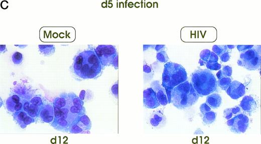 Fig. 5. Cell morphology of mock and HIV-infected MKs (representative results). Cells from day 0 infection harvested at day 9 (A) and at day 12 (B). MKs infected at day 5 and recovered at day 12 (C). May-Grünwald staining; original magnification × 400.