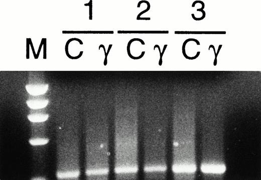 Fig. 5. Detection of FasL mRNA by RT-PCR in human ECFCs. Day-5 cells from three donors were cultured in control (C) medium or with 1,000 U/mL rhIFNγ (γ) for 3 days and total RNA was prepared followed by RT-PCR for FasL. The PCR product corresponding to FasL (346 bp) was purified after electrophoresis and verified by sequencing (marker, ◊x174 DNA-Hae III digest).