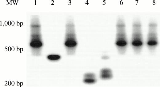 Fig. 5. Clonal analysis by inverse PCR of marked human T-cell and myeloid colonies recovered from mice transplanted with CD34+CD38− cells. (A) G418-resistant human CFU-GM was recovered from the marrow of 2/14 mice transplanted with CD34+CD38−cells subjected to a 72-hour transduction. The clonal diversity of the individual, marked human myeloid colonies was assessed by single-colony inverse PCR. Colonies shown are from the mouse that had 17/240 G418-resistant progenitors (Table 2). (B) Human T-cell and myeloid colonies were grown from mice transplanted with CD34+CD38− cells transduced for 7 days with FL (Table 3). Colonies from two of the four mice were shown to contain the neo gene by PCR, then were futher subjected to single-colony inverse PCR. Panels B and C show amplified inverse PCR products from marked T-cell and myeloid colonies obtained from each mouse. T = T lymphoid clones. M = myeloid clones.
