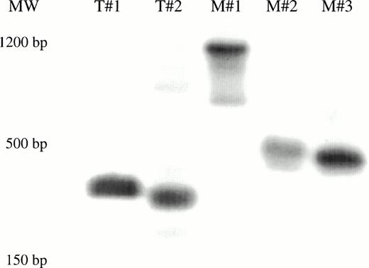 Fig. 5. Clonal analysis by inverse PCR of marked human T-cell and myeloid colonies recovered from mice transplanted with CD34+CD38− cells. (A) G418-resistant human CFU-GM was recovered from the marrow of 2/14 mice transplanted with CD34+CD38−cells subjected to a 72-hour transduction. The clonal diversity of the individual, marked human myeloid colonies was assessed by single-colony inverse PCR. Colonies shown are from the mouse that had 17/240 G418-resistant progenitors (Table 2). (B) Human T-cell and myeloid colonies were grown from mice transplanted with CD34+CD38− cells transduced for 7 days with FL (Table 3). Colonies from two of the four mice were shown to contain the neo gene by PCR, then were futher subjected to single-colony inverse PCR. Panels B and C show amplified inverse PCR products from marked T-cell and myeloid colonies obtained from each mouse. T = T lymphoid clones. M = myeloid clones.