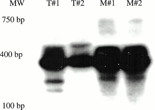 Fig. 5. Clonal analysis by inverse PCR of marked human T-cell and myeloid colonies recovered from mice transplanted with CD34+CD38− cells. (A) G418-resistant human CFU-GM was recovered from the marrow of 2/14 mice transplanted with CD34+CD38−cells subjected to a 72-hour transduction. The clonal diversity of the individual, marked human myeloid colonies was assessed by single-colony inverse PCR. Colonies shown are from the mouse that had 17/240 G418-resistant progenitors (Table 2). (B) Human T-cell and myeloid colonies were grown from mice transplanted with CD34+CD38− cells transduced for 7 days with FL (Table 3). Colonies from two of the four mice were shown to contain the neo gene by PCR, then were futher subjected to single-colony inverse PCR. Panels B and C show amplified inverse PCR products from marked T-cell and myeloid colonies obtained from each mouse. T = T lymphoid clones. M = myeloid clones.
