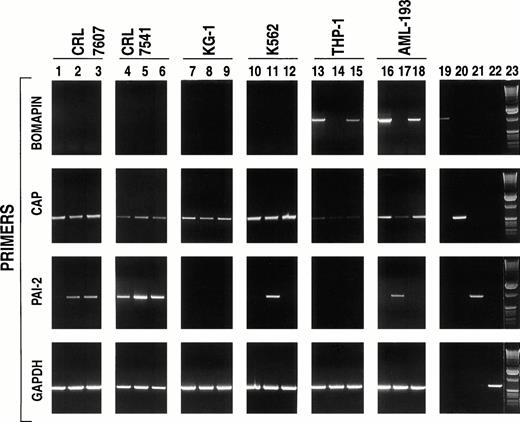 Fig. 2. PCR analysis of cell lines derived from bone marrow or peripheral blood of patients with various types of leukemia. The indicated cell lines (CRL 7607, lanes 1-3; CRL 7541, lanes 4-6; KG-1, lanes 7-9; K562, lanes 10-12; THP-1, lanes 13-15; and AML-193, lanes 16-17) were incubated in serum-containing media (106cells/mL, 25 mL/162 cm2 flask) in the absence (lanes 1, 4, 7, 10, 13, and 16) or presence of either PMA (10-8 mol/L, lanes 2, 5, 8, 11, 14, and 17) or TNF-α (30 U/mL; lanes 3, 6, 9, 12, 15, and 18). After 24 hours, the cells were washed by centrifugation and total RNA was isolated, reverse transcribed, and subjected to PCR amplification using primers specific to bomapin (first row, primer pair B2, amplification product: 1,195 base pairs), CAP (second row, primer pair C2, amplification product: 607 base pairs), PAI-2 (third row, amplification product: 897 base pairs), and GAPDH (fourth row, amplification product: 695 base pairs). The PCR products were subjected to electrophoresis in a 1% agarose gel and stained with ethidium bromide. Lanes 19-22 show the PCR products obtained using the aforementioned primers to amplify the vectors containing the cDNAs encoding bomapin (lane 19), CAP (lane 20), PAI-2 (lane 21), or GAPDH (lane 22). Lane 23 contains a 1-kb DNA ladder.