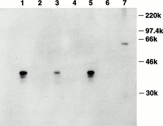 Fig. 4. Detection of bomapin antigen in control and PMA- or TNF-α–treated THP-1 cells. THP-1 cells (106 cells/mL, 25 mL/flask, 162 cm2/flask) were incubated in serum-containing media in the absence (lanes 1 and 2) or presence of either PMA (10−8 mol/L; lanes 3 and 4) or TNF-α (30 U/mL; lanes 5 and 6) as described above. After 72 hours, the cells were washed twice, homogenized, and centrifuged, and the cytosol preparations (1 mg) were incubated with either Sepharose-antibomapin (lanes 1, 3, and 5) or Sepharose-normal rabbit IgG (lanes 2, 4, and 6). The beads were washed and the material eluting with SDS-sample buffer was analyzed by immunoblotting using biotin-labeled affinity purified antibomapin, streptavidin-peroxidase, and the enhanced chemiluminescence detection system. Lane 7 contained 300 ng of GST-bomapin.
