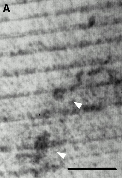 Fig. 5. Resorption pits formed by CFU-O–derived colonies in the c-kithigh cell population. (A) Cells from a colony developed in the presence of CESJ medium were cocultured with a dentine slice on ST2 cells for 14 days as described in the Materials and Methods section. Pits, indicated by arrowheads, were visualized by staining with Coomassie blue. (B) A control dentine slice incubated only with ST2 cells for 14 days. Multiple dark dots and lines seen throughout the specimen are dentinal tubules, whereas parallel regular lines are saw marks. Scale bars represent 100 μm (A and B).