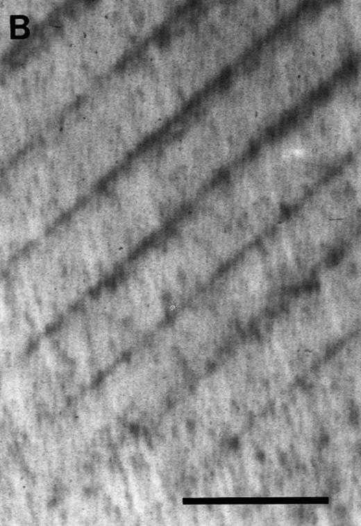 Fig. 5. Resorption pits formed by CFU-O–derived colonies in the c-kithigh cell population. (A) Cells from a colony developed in the presence of CESJ medium were cocultured with a dentine slice on ST2 cells for 14 days as described in the Materials and Methods section. Pits, indicated by arrowheads, were visualized by staining with Coomassie blue. (B) A control dentine slice incubated only with ST2 cells for 14 days. Multiple dark dots and lines seen throughout the specimen are dentinal tubules, whereas parallel regular lines are saw marks. Scale bars represent 100 μm (A and B).