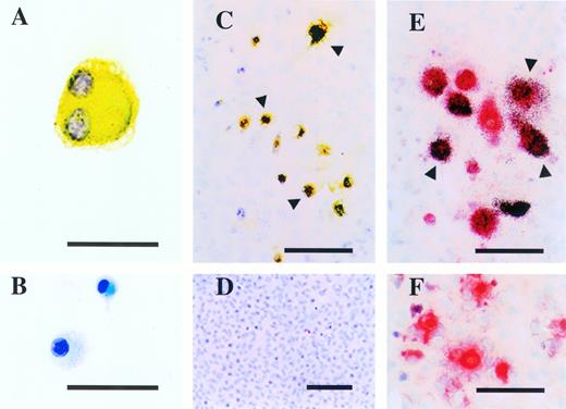 Fig. 4. Expression of osteoclast markers on CFU-O derived colony cells in the c-kitlow population. (A) Cytospot samples prepared from day-14 agarose cultures were stained for αvβ3 vitronectin receptors. Note a large multinucleated cell showing positive reaction to anti-VTR. (B) Negative control stained for B220. (C) Cells from individual CFU-O–derived colonies cocultured for 7 days with ST2 cells in the presence of 1,25(OH)2D3 and hydrocortisone and then stained with anti-src. Note a group of cells expressing c-src (arrowheads) over the monolayer of ST2 cells in the background. (D) No positive staining on ST2 cells that were reacted with anti-src. (E) Autoradiography of cells from individual CFU-O–derived colonies cocultured for 14 days with ST2 cells in the presence of 1,25(OH)2D3and hydrocortisone and then exposed to 125I-CT. Note a group of TRAPase-positive cells covered with dense silver grains (arrowheads) indicating the expression of calcitonin receptors. (F) Absence of 125I-CT binding to cells incubated with an excess amount of cold CT. Scale bars represent 50 μm (A and B), 100 μm (C, E, and F), and 150 μm (D).