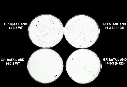 Fig. 4. β-Galactosidase colony filter-lift assays of GPIb/14-3-3ζ yeast 2-hybrid transformations. Reporter gene activity is reflected by expression of blue (dark) colonies, most notable with the combination of GPIbβ and full-length 14-3-3ζ, followed by GPIbβ and deletion mutant 14-3-3 (1-123) and GPIbα and full-length 14-3-3ζ. The X-gal substrate used in these assays is considered more sensitive to β-galactosidase activity than the ONPG used in the quantitative assays in Figs 2 and 3.