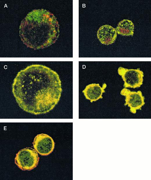 Fig. 5. Colocalization of GPIb subunits and 14-3-3ζ in HEL cells (A to E) and platelets (F to I). Permeabilized platelets and HEL cells were colabeled with antibody pairs. HEL cells were labeled with either (A) anti-GPIbα/FITC (green) and anti-CD62P/CY-3 (red) (negative control), (B) anti–14-3-3ζ/FITC and anti-CD62P/CY-3 (negative control), (C) anti-GPIbα/FITC and anti-GPIX/CY-3 (positive control), (D) anti-GPIbβ/CY-3 and anti–14-3-3ζ/FITC, or (E) anti-GPIbα/CY-3 and anti–14-3-3ζ/FITC. Inset: detector 1, FITC fluorescence intensity; detector 2, CY-3 fluorescence intensity. Yellow fluorescence suggests that the 2 antibodies colocalize to within approximately 200 nm. A and C to E field size, 36 × 36 μm; B field size, 54 × 54 μm. Representative platelet pixel histograms for each antibody pair are shown. / (F to I) and reflect colocalization of GPIX/Ibα (G), GPIbβ/14-3-3ζ (H), and GPIbα/14-3-3ζ (I). Note the approximately equal contribution from each fluorochrome-conjugated secondary antibody at different fluorescence intensities in G (positive control), H, and I. This suggests that each computer pixel is detecting an equal amount of both antibodies present, which implies their respective epitopes are present in equal amounts (colocalized) in the 3-dimensional volume scanned by the microscope. This contrasts with F (1 of 2 negative controls), in which a diffuse pattern reflecting noncolocalization is seen. Three experiments with HEL cells and 2 with platelets were performed.