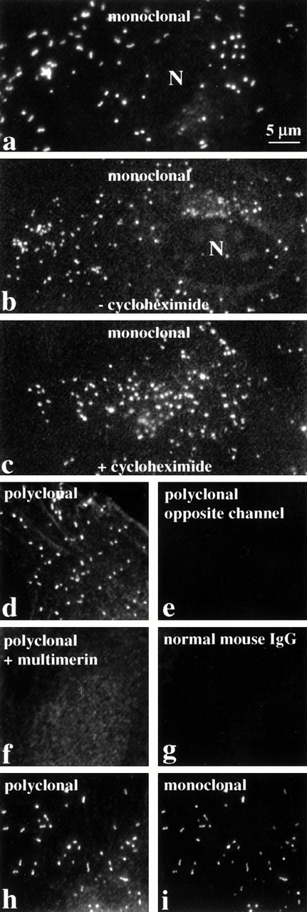 Fig. 1. The intracellular distribution of multimerin in endothelial cells, evaluated by indirect immunolabeling and epifluorescent microscopy. Fixed, permeabilized endothelial cells were labeled with monoclonal and polyclonal antimultimerin, normal mouse IgG, or polyclonal antimultimerin preadsorbed with purified multimerin or with buffer (N indicates cell nuclei). The granular staining was similar in cells cultured for 24 hours with (c) or without (b) the protein synthesis inhibitor cycloheximide. Most of the multimerin-labeled granules were round to slightly elongated (b, c, d), but rod-shaped granules were also seen in some cells (a, h, i). The same cytoplasmic structures in endothelial cells were recognized by monoclonal and polyclonal antimultimerin (h and i show identical fields of a double-labeled cell). No fluorochrome was detected in the opposite channel of single labeled cells (d and e are paired images; same magnification, all panels).