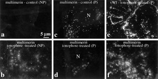 Fig. 2. Redistribution of multimerin after treatment of endothelial cells with secretagogues. Cells were washed and resuspended in fresh, serum-free culture media before treatment with and without ionophore A23187. Nonpermeabilized (NP) and permeabilized (P) cells were labeled with antimultimerin (a and b), antimultimerin and anti–von Willebrand factor (e and f), or with antimultimerin and propidium iodide to visualize cell nuclei (c and d show the multimerin-labeled structures associated with cells that contained labeled nuclei). Standard immunofluorescent microscopy images of endothelial cells processed 30 (a-d) and 60 minutes (e and f) after treatment with buffer or ionophore illustrate the redistribution of multimerin in response to secretagogues (N indicates cell nuclei) and the different distributions of multimerin and von Willebrand factor associated with secretagogue-treated endothelial cells (e and f).