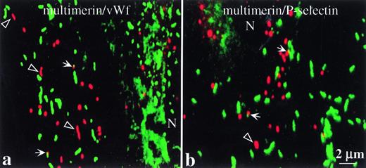 Fig. 4. Confocal scanning laser microscopy images comparing the intracellular distributions of multimerin with von Willebrand factor and P-selectin. Cells were prepared as in Fig 3. The images are overlays of matching 250 nm optical sections (taken through the cellular plane showing the maximal intensity granular labeling for both proteins) and show labeled structures in the cytoplasm of endothelial cells. Multimerin is shown in red, and P-selectin and von Willebrand factor are shown in green (N indicates the cell nuclei). Differences are seen in the distributions of multimerin, compared to von Willebrand factor and P-selectin. Some of the elongated multimerin-labeled granules (open arrowheads) did not contain detectable von Willebrand factor or P-selectin immunolabel. Regions of possible overlap in the distributions of multimerin and von Willebrand factor or P-selectin are indicated (solid arrows).