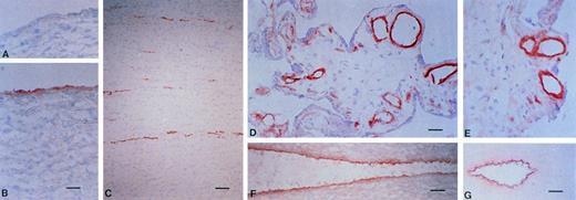 Fig. 5. The distribution of multimerin in normal blood vessels. Frozen sections of normal tissue, including aorta (A and B), small bowel (C), placenta (D and E), carotid artery (F), and umbilical cord (G; vein is shown) were immunolabeled with monoclonal antimultimerin (B, C, D, F, and G), polyclonal anti-multimerin (E), or the preimmune polyclonal antiserum (A). Bars indicate 30 μm (C and G) and 10 μm (A, B, D, E, and F).