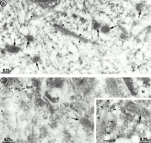 Fig. 6. Immunoelectron microscopy studies of human umbilical vein endothelial cells. (a) Cells labeled with multimerin antibodies. Gold particles were located in round dense-core granules (arrows) and less often in elongated structures (arrowheads) that closely resembled Weibel-Palade bodies. (b and inset) Cells double immunolabeled for multimerin (10 nm gold) and P-selectin (15 nm gold). Multimerin immunolabel was mainly observed in dense-core granules (arrows) that were negative for P-selectin. P-selectin– positive Weibel-Palade bodies (WP; arrowheads) displayed either low levels (b) or no detectable (inset) multimerin immunolabel. N indicates the cell nucleus.