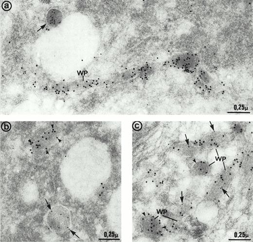 Fig. 7. Immunoelectron micrographs of human umbilical vein endothelial cells double-immunolabeled with antibodies to multimerin (10 nm gold) and von Willebrand factor (15 nm gold). (a) Most of the multimerin-positive granules were round in shape (arrows) and distinct from the von Willebrand factor-containing elongated Weibel-Palade bodies (WP). (b) Two dense-core granules of similar size with distinct appearances and contents. One is elongated and contains von Willebrand factor (arrowheads) whereas the other one is more spherical and contains multimerin (arrows). (c) Weibel-Palade (WP) bodies containing von Willebrand factor were generally devoid of multimerin (arrowheads). Occasionally, both proteins were found in their matrix, but the labeling for multimerin (arrows) was minimal compared to von Willebrand factor.