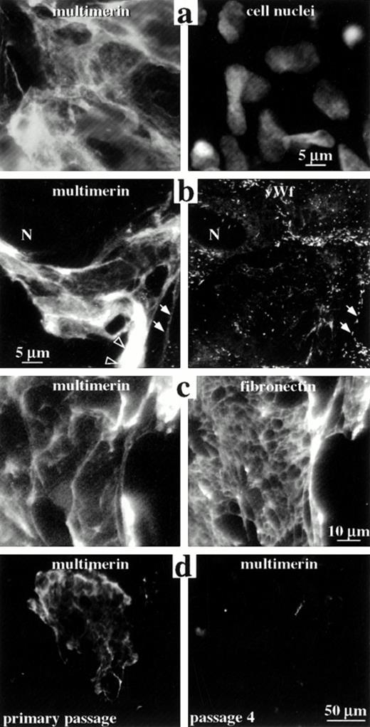 Fig. 8. The distribution of multimerin in the extracellular matrix of endothelial cells. Nonpermeabilized (a and c) and permeabilized (b and d) endothelial cells were labeled with monoclonal antibodies to multimerin (a-d), polyclonal antibodies to von Willebrand factor (b), polyclonal antibodies to fibronectin (c), and propidium iodide (to visualize cell nuclei; a), and were examined by epifluorescent microscopy. Panels a to c show paired images of the same field of primary passage endothelial cells. The cells shown in panel b contained few multimerin granules but abundant von Willebrand factor granules (N indicates a cell nucleus). Solid arrows indicate regions where the von Willebrand factor-labeled Weibel-Palade bodies in the cell periphery appeared to follow the margins of the multimerin-containing fibrils. Open arrowheads indicate multimerin in thicker, intensely labeled structures. Multimerin and fibronectin were associated with large fibrillary structures in the extracellular matrix (c), with differences in their distributions. Cell passage in vitro was associated with reduced extracellular matrix staining for multimerin (d).