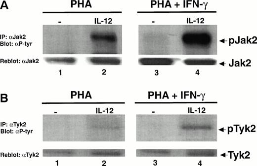 Fig. 5. Activation of T cells with PHA + IFN-γ augments whereas activation with PHA + IL-4 inhibits the IL-12–induced tyrosine phosphorylation of Jak2 and Tyk2. PBMC were cultured with either PHA, PHA + IFN-γ (A and B), or PHA + IL-4 (C and D), and T cells were then stimulated with medium alone (lanes 1 and 3) or IL-12 (lanes 2 and 4). Immunoprecipitations were performed on whole cell lysates with an antibody to Jak2 (A and C) or Tyk2 (B and D) followed by Western blots using an antiphosphotyrosine antibody (upper panels) or antibodies to either Jak2 or Tyk2 (lower panels). Each result is representative of two separate experiments.