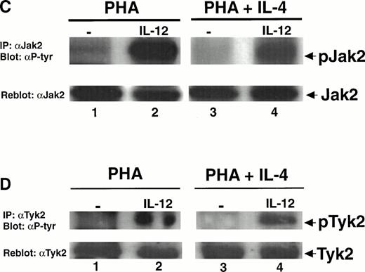 Fig. 5. Activation of T cells with PHA + IFN-γ augments whereas activation with PHA + IL-4 inhibits the IL-12–induced tyrosine phosphorylation of Jak2 and Tyk2. PBMC were cultured with either PHA, PHA + IFN-γ (A and B), or PHA + IL-4 (C and D), and T cells were then stimulated with medium alone (lanes 1 and 3) or IL-12 (lanes 2 and 4). Immunoprecipitations were performed on whole cell lysates with an antibody to Jak2 (A and C) or Tyk2 (B and D) followed by Western blots using an antiphosphotyrosine antibody (upper panels) or antibodies to either Jak2 or Tyk2 (lower panels). Each result is representative of two separate experiments.