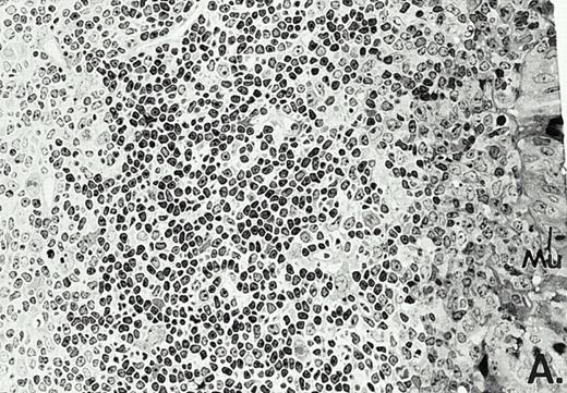 Fig. 3. Marked changes in the C3H/HeN CLP mouse Peyer's patch histology are evident at both the light microscopic (A v B) level and at the electron microscopic level (C v D) 24 hours postsham or CLP. (A) Illustrates typical lymphocyte morphology. The figure is oriented with the mucosal epithelia (Mu) appearing on the right side of the picture moving towards the germinal center on the left-hand side (magnification = 216X). (C) Shows normal lymphocytic morphology encountered at an electron microscopic level in the sham mouse's Peyer's patch (magnification = 4825X). (B) Alternatively, shows changes typically encounter in the Peyer's patch of a septic mouse at a light microscopic level. Clusters of apoptotic cells (Apo), with condense nuclei, can be observed, appearing to increase in frequency within the germinal center of the CLP mouse's Peyer's patch, as opposed to the T-cell zone adjacent to the mucosal epithelia (Mu)(magnification = 216X). (D) Electron microscopic inspection of a typically cluster of apoptotic cells within the germinal center showed marked nuclear condensation (CN), cytoplasmic shrinkage, as well as evidence of apoptotic fragmentation (Apo)(magnification = 4825X).