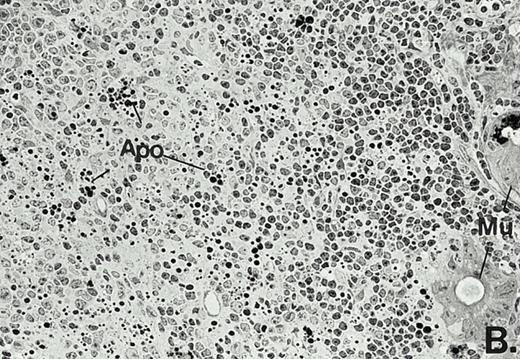 Fig. 3. Marked changes in the C3H/HeN CLP mouse Peyer's patch histology are evident at both the light microscopic (A v B) level and at the electron microscopic level (C v D) 24 hours postsham or CLP. (A) Illustrates typical lymphocyte morphology. The figure is oriented with the mucosal epithelia (Mu) appearing on the right side of the picture moving towards the germinal center on the left-hand side (magnification = 216X). (C) Shows normal lymphocytic morphology encountered at an electron microscopic level in the sham mouse's Peyer's patch (magnification = 4825X). (B) Alternatively, shows changes typically encounter in the Peyer's patch of a septic mouse at a light microscopic level. Clusters of apoptotic cells (Apo), with condense nuclei, can be observed, appearing to increase in frequency within the germinal center of the CLP mouse's Peyer's patch, as opposed to the T-cell zone adjacent to the mucosal epithelia (Mu)(magnification = 216X). (D) Electron microscopic inspection of a typically cluster of apoptotic cells within the germinal center showed marked nuclear condensation (CN), cytoplasmic shrinkage, as well as evidence of apoptotic fragmentation (Apo)(magnification = 4825X).