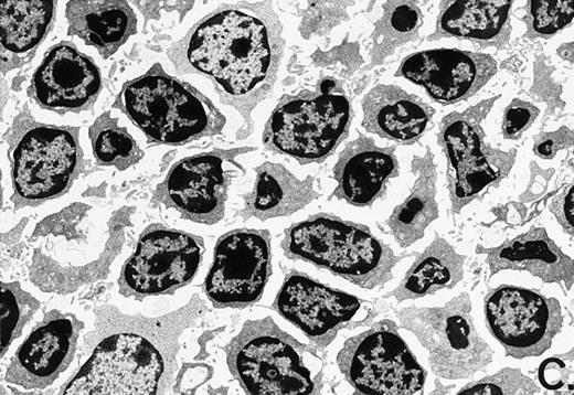 Fig. 3. Marked changes in the C3H/HeN CLP mouse Peyer's patch histology are evident at both the light microscopic (A v B) level and at the electron microscopic level (C v D) 24 hours postsham or CLP. (A) Illustrates typical lymphocyte morphology. The figure is oriented with the mucosal epithelia (Mu) appearing on the right side of the picture moving towards the germinal center on the left-hand side (magnification = 216X). (C) Shows normal lymphocytic morphology encountered at an electron microscopic level in the sham mouse's Peyer's patch (magnification = 4825X). (B) Alternatively, shows changes typically encounter in the Peyer's patch of a septic mouse at a light microscopic level. Clusters of apoptotic cells (Apo), with condense nuclei, can be observed, appearing to increase in frequency within the germinal center of the CLP mouse's Peyer's patch, as opposed to the T-cell zone adjacent to the mucosal epithelia (Mu)(magnification = 216X). (D) Electron microscopic inspection of a typically cluster of apoptotic cells within the germinal center showed marked nuclear condensation (CN), cytoplasmic shrinkage, as well as evidence of apoptotic fragmentation (Apo)(magnification = 4825X).