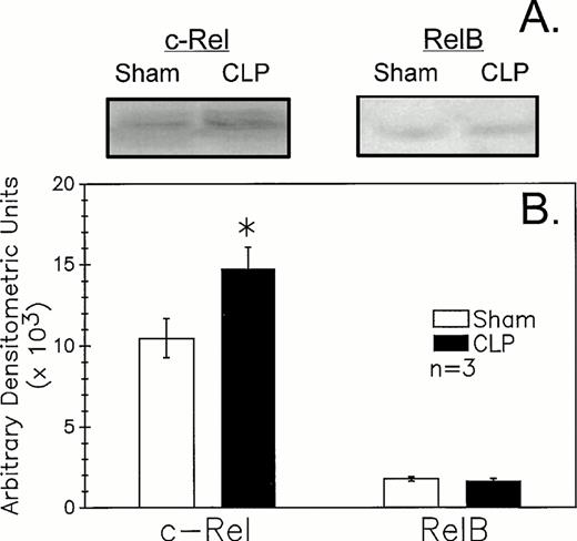 Fig. 7. CLP of C3H/HeN mice typically induced an increase in B220+ cell nuclear extract c-Rel expression (A) as compared to sham mouse cells at 24 hours observed by Western immunoblot analysis. Alternatively, RelB expression (B) although evident is not typically markedly different in extracts from sham or CLP mice. These densitometric results are presented for three repeated independent experiments.