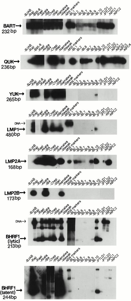 Fig. 1. Autoradiography showing representative Southern blot hybridization of RT-PCR products for eBL tumors and BL cell lines.