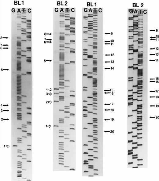 Fig. 3. Genomic sequencing for bisulfite-treated DNA from eBL tumors for Qp. For bisulfite sequencing, the unmethylated C residue (or G at the opposite strand) within a CpG site will be converted to T (or A) in sequencing gel, whereas the methylated C residue is not changed. CpG sites 1 to 8 were sequenced from one direction, whereas CpG sites 9 to 20 were sequenced from another direction. All 16 CpG sites immediately downstream of the initiation site of Fp were unmethylated in BL1 and BL2. However, the 4 CpG sites upstream of the initiation site of Fp were methylated in BL2. Dark arrows indicate unmethylated CpG dinucleotides and open arrows indicate methylated CpG dinucleotides.
