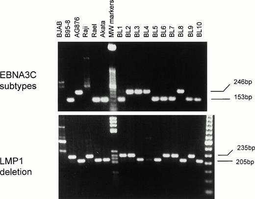 Fig. 4. Genotyping for EBNA3C subtypes and LMP1 gene deletion by PCR in eBL tumors and BL cell lines. A 153-bp band for type-A EBV and a 246-bp band for type B virus are shown. A 30-bp deletion at the carboxyl terminus of LMP1 gene is shown by the shorter PCR product of 205-bp, rather than a 235-bp band for the wild-type LMP1 gene.