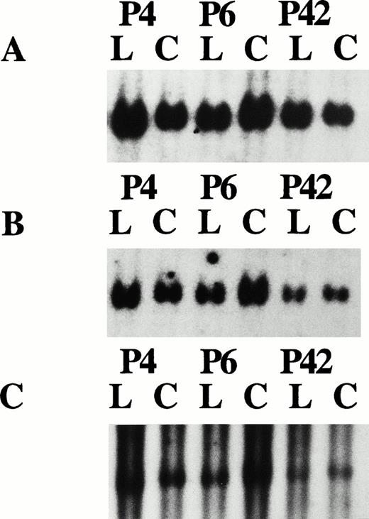 Fig. 3. Autoradiograph results for patients P4, P6, and P42. The leukemic (L) and control (C) DNA was EcoR1 digested, size fractionated on 1% agarose gel, and hybridized with the following probes: (A) Control probe β-interferon; (B) p92c, with densitometry results of 0.94, 0.92, and 0.52, respectively, compared with the control signals showing homozygous retention, homozygous retention, and hemizygous loss, respectively; and (C) p25b, with densitometry results of 1.12, 0.92, and 0.57, respectively, compared with the control showing homozygous retention, homozygous retention, and hemizygous loss, respectively.